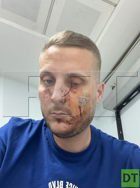 �� ������������ ����������� ������ ��-�� ������� �� ��������