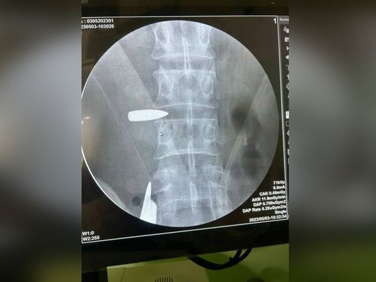 ���������� ������� ������� ���� �� ������������ ��������� ���