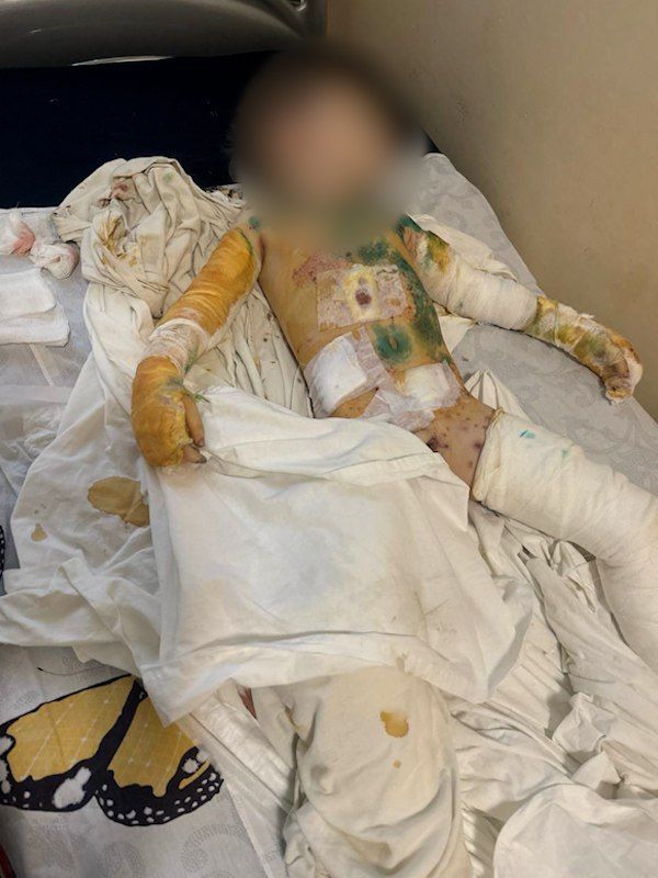 ������� ��������: ������� ���� ��� �������� ������