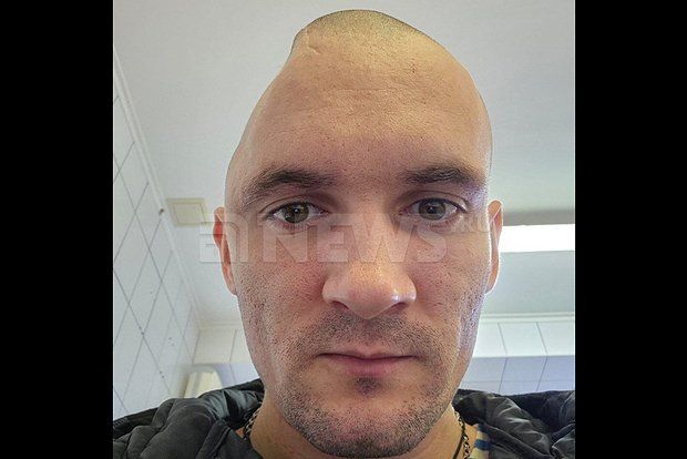 В Петербурге бойца СВО без части черепа разрешили отправить на гауптвахту