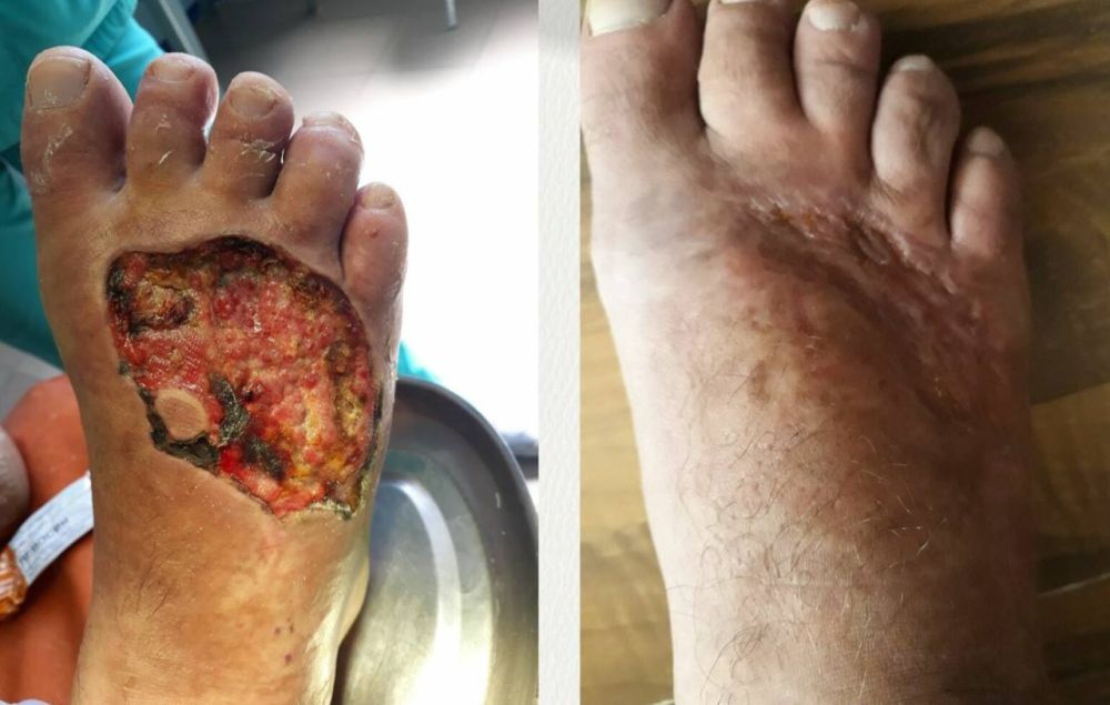 ������ �������: ������������ ��������� �������;