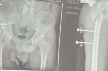 ��������� ������ ������� ���������� ��������, ������� �� ������� �������� ���