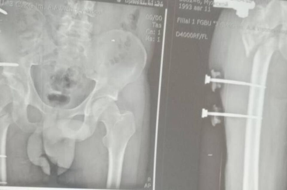 ��������� ������ ������� ���������� ��������, ������� �� ������� �������� ���