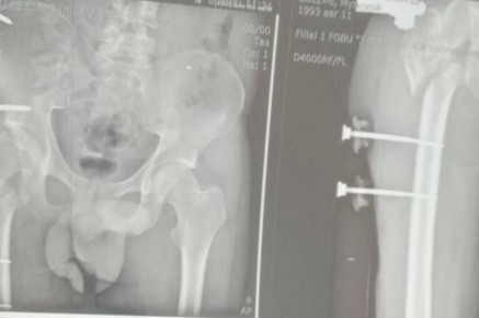 ��������� ������ ������� ���������� ��������, ������� �� ������� �������� ���