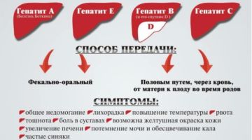 "�������� �������� - ��� ������ ������������ ����������� ������, ��������� �������������� �������� (A, B, C, D, E). ������ �������� ������� ������ � ����� ������� ������ ������� � ���� ������