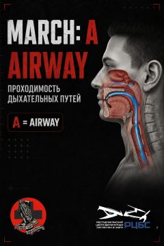 MARCH: A - AIRWAY. ����� ��������� ���������� ������������ ��������� � ���������� ����� ��������� MARCH - A (Airway), ������������ ����������� �����